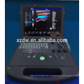 DW-C60 portátil equipo de función 4D color doppler portátil máquina de ultrasonido